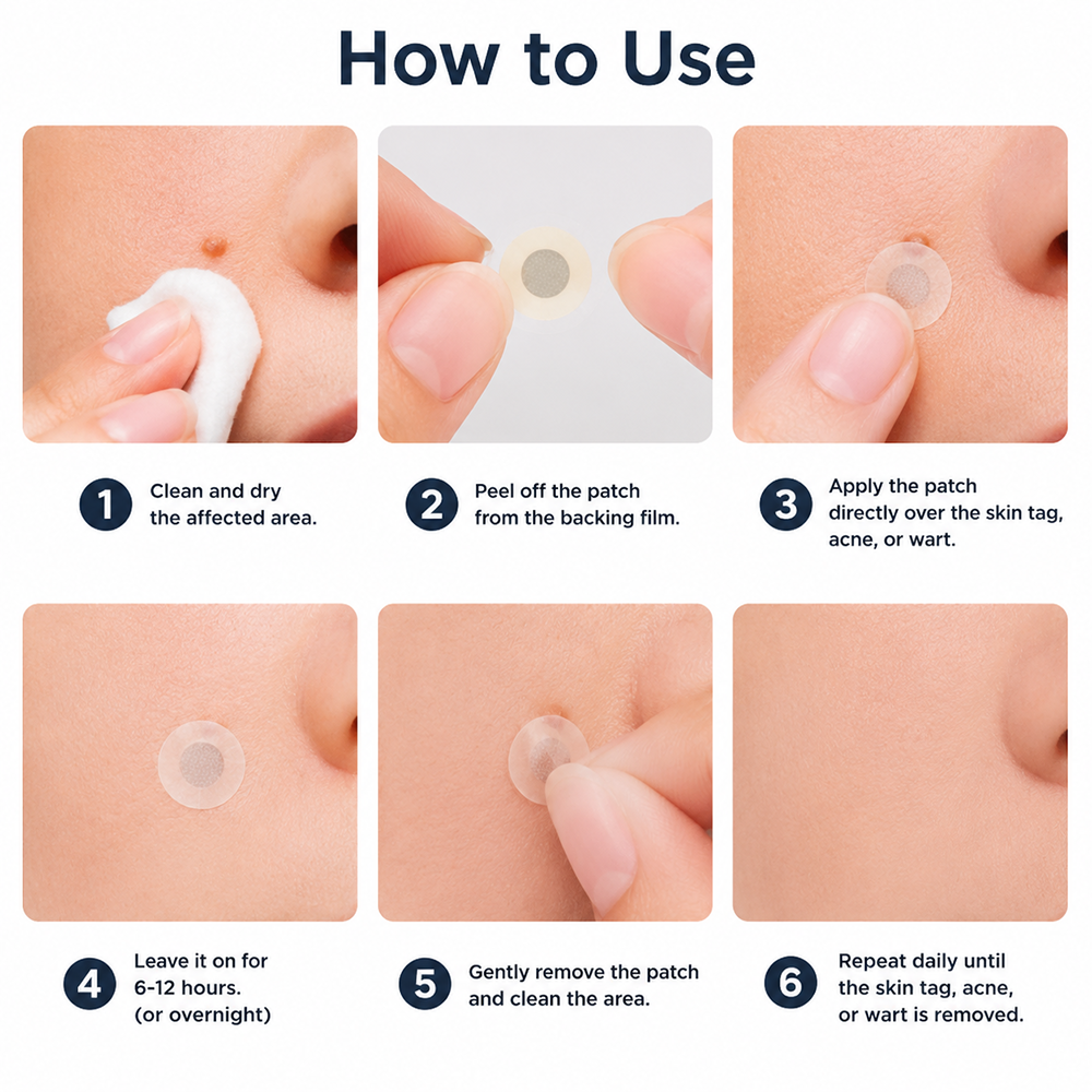 ✨【30%OFF only today】Hiskin ® 2-in-1 Microneedle & Hydrocolloid Patch🍀 | Removes raised moles, acne, flat warts, and skin tags | Helps improve wrinkles, scars, and blemishes | Invisible patches for face and body