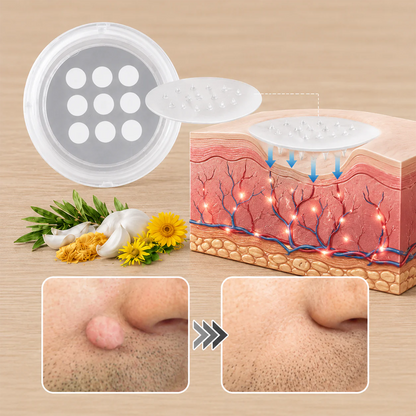 ✨【30%OFF only today】Hiskin ® 2-in-1 Microneedle & Hydrocolloid Patch🍀 | Removes raised moles, acne, flat warts, and skin tags | Helps improve wrinkles, scars, and blemishes | Invisible patches for face and body